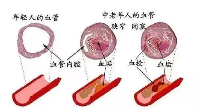 孕妇服用欧米伽-3可降低14%胎儿早产几率 同时可保护心脏及大脑健康